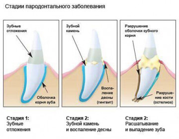 Камень Десен Фото